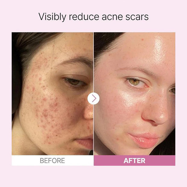 The Niacinamide 15 Serum