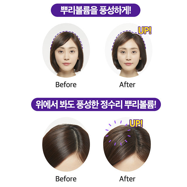 Ryo | Hair Loss Expert Care Treatment 330mL | Moona.Store – Moona