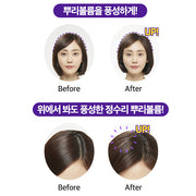 Hair Loss Expert Care Treatment 330mL